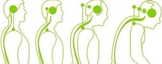 Cervical spine incapacitation