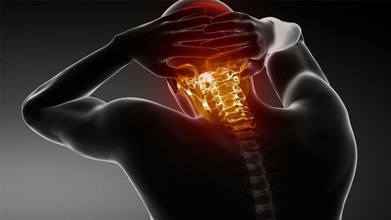 Pain in the back of the head caused by cervical osteochondrosis