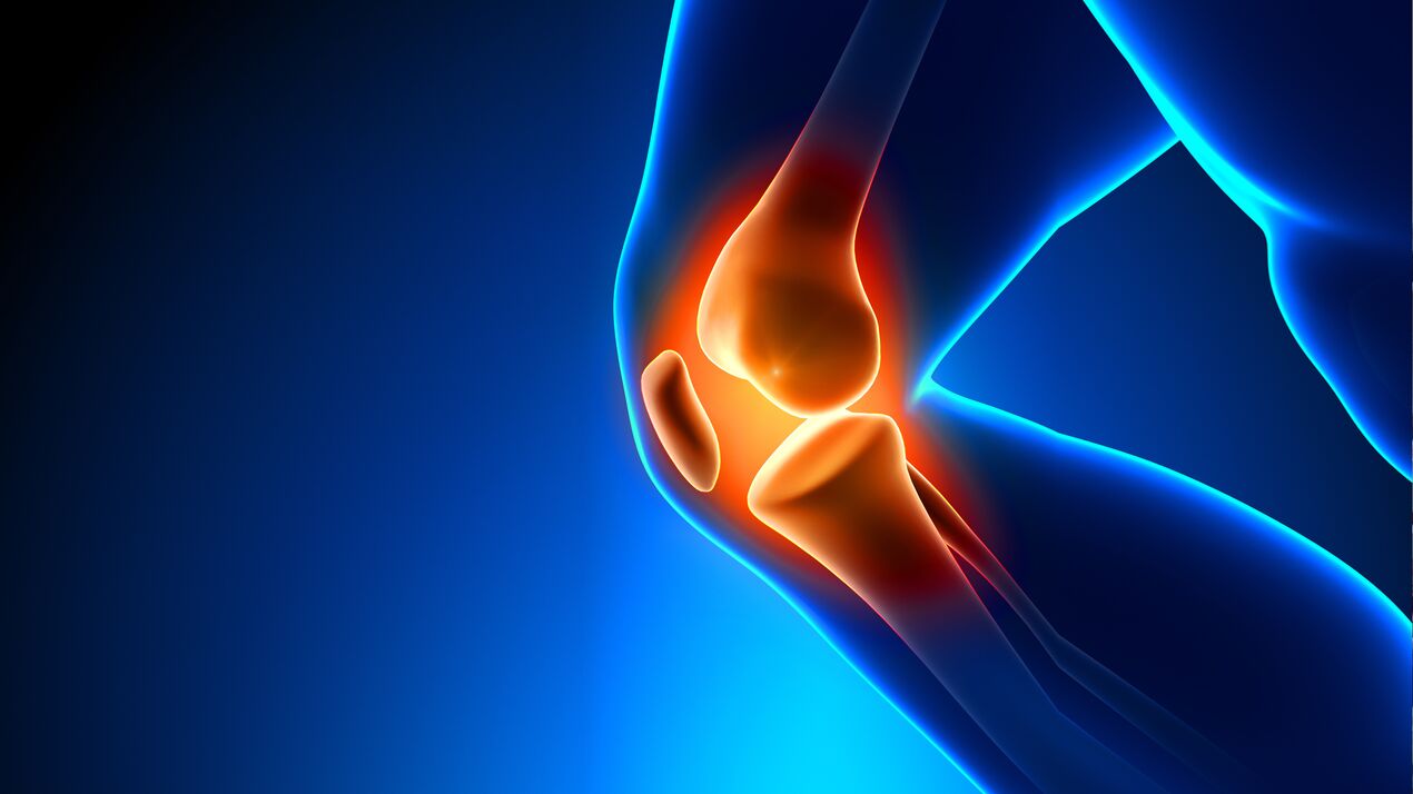 Arthropathy of the joints