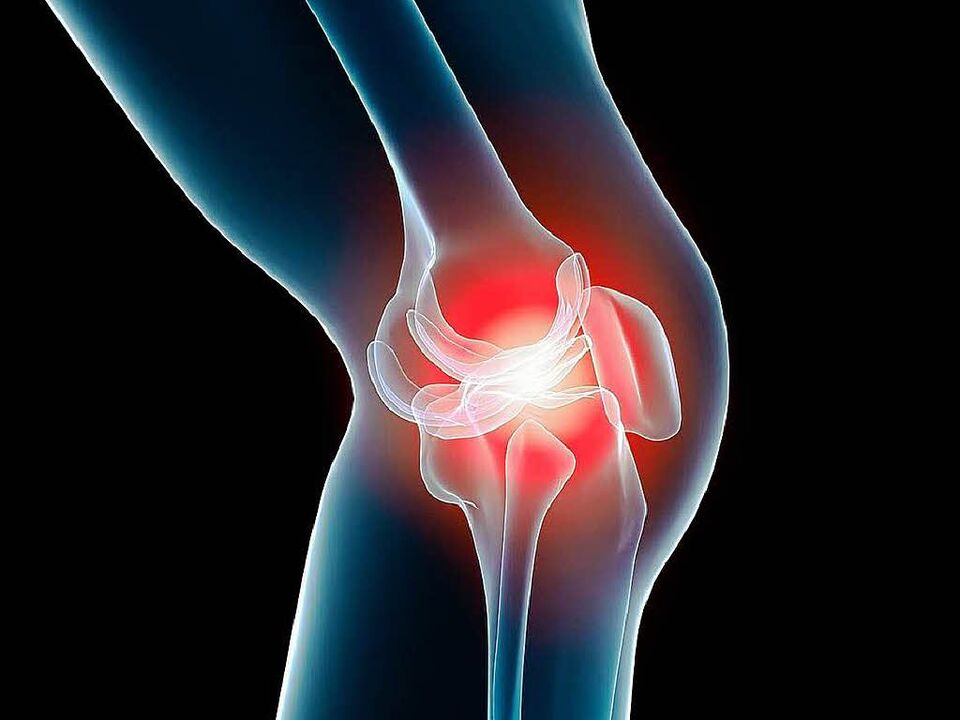 knee joint disease